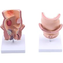 Rectal Demo Model - Human Organ Anatomy Model Anorectal Model - Medical Teaching Model - Model Of Anorectal Anatomy Model